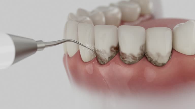 Trusted Teeth Cleaning And Checkup service in Rosedale, WA - Dentist Open Now
